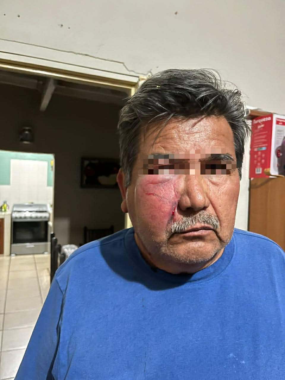 Da golpiza a su madre abuela y también a tío