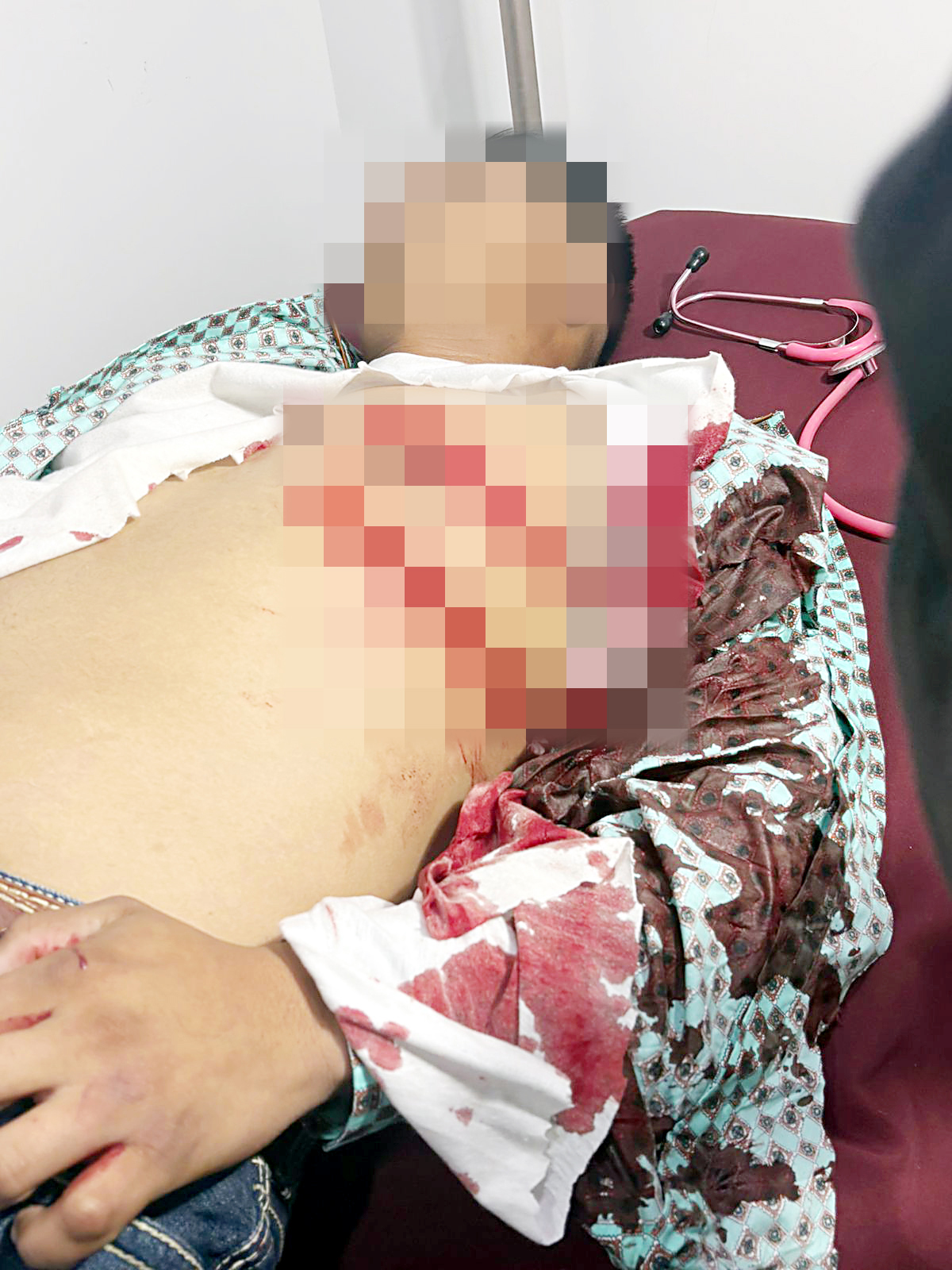 Grave un joven vaquero; quiso meter paz en riña