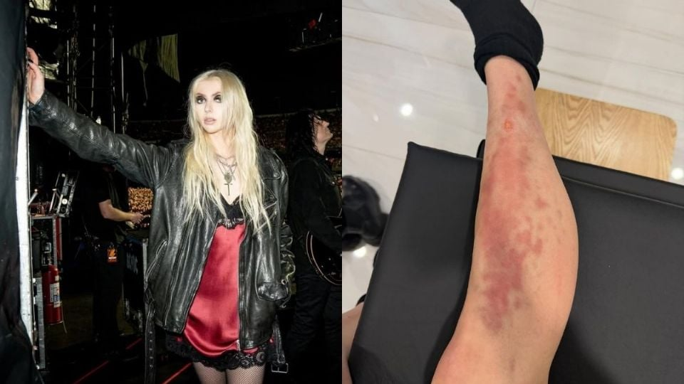 La cantante Taylor Momsen es hospitalizada en México tras picadura de araña venenosa